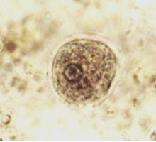 AMIBIASIS - HIPERnatural.COM