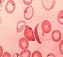 Anmiedescellules - HIPERnatural.COM