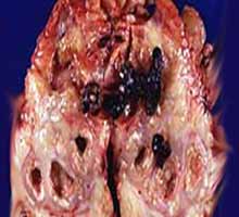 Lescalculsrnaux - HIPERnatural.COM