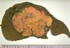 CANCERDUFOIE - HIPERnatural.COM