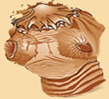 Cysticercose - HIPERnatural.COM