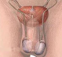 TesticularDOULEUR - HIPERnatural.COM