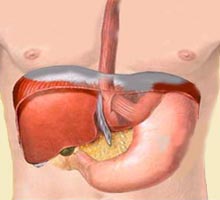 Herniehiatale - HIPERnatural.COM