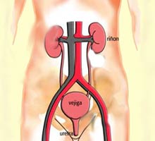 Lesinfectionsdesvoiesurinaires - HIPERnatural.COM