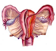 Uterinemyomas - HIPERnatural.COM