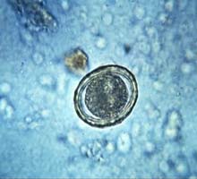 OXIUROSIS - HIPERnatural.COM