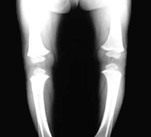 ARCLEGS - HIPERnatural.COM