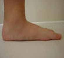 Congnitalesproblmesdepieds - HIPERnatural.COM
