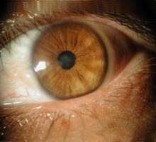 Lartinopathiediabtique - HIPERnatural.COM