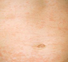 Rosole - HIPERnatural.COM
