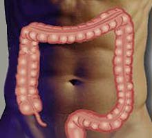 Lesyndromeduclonirritable - HIPERnatural.COM