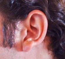 Acouphneoubourdonnementdanslesoreilles - HIPERnatural.COM